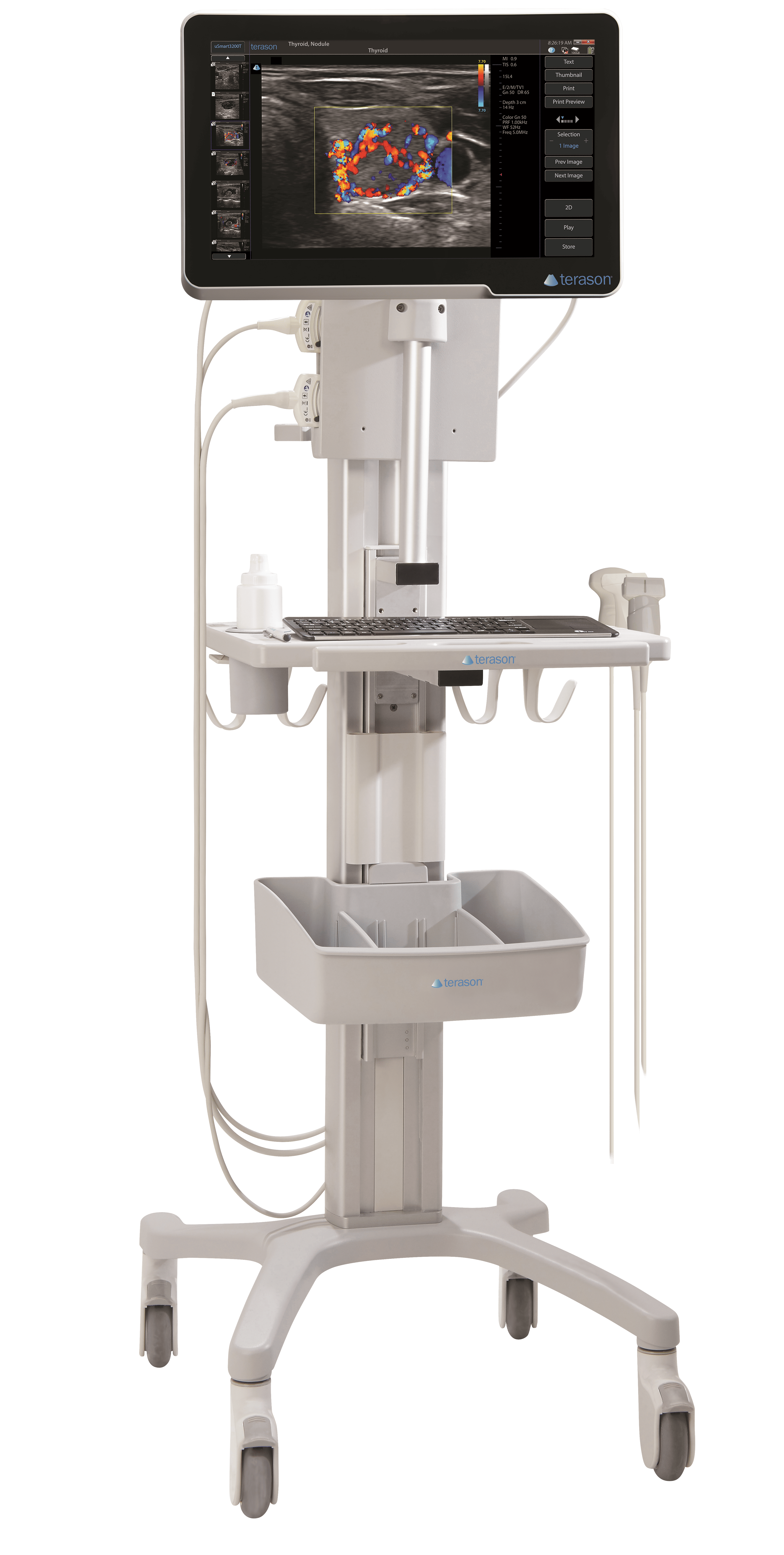 Terason uSmart 3200T Plus