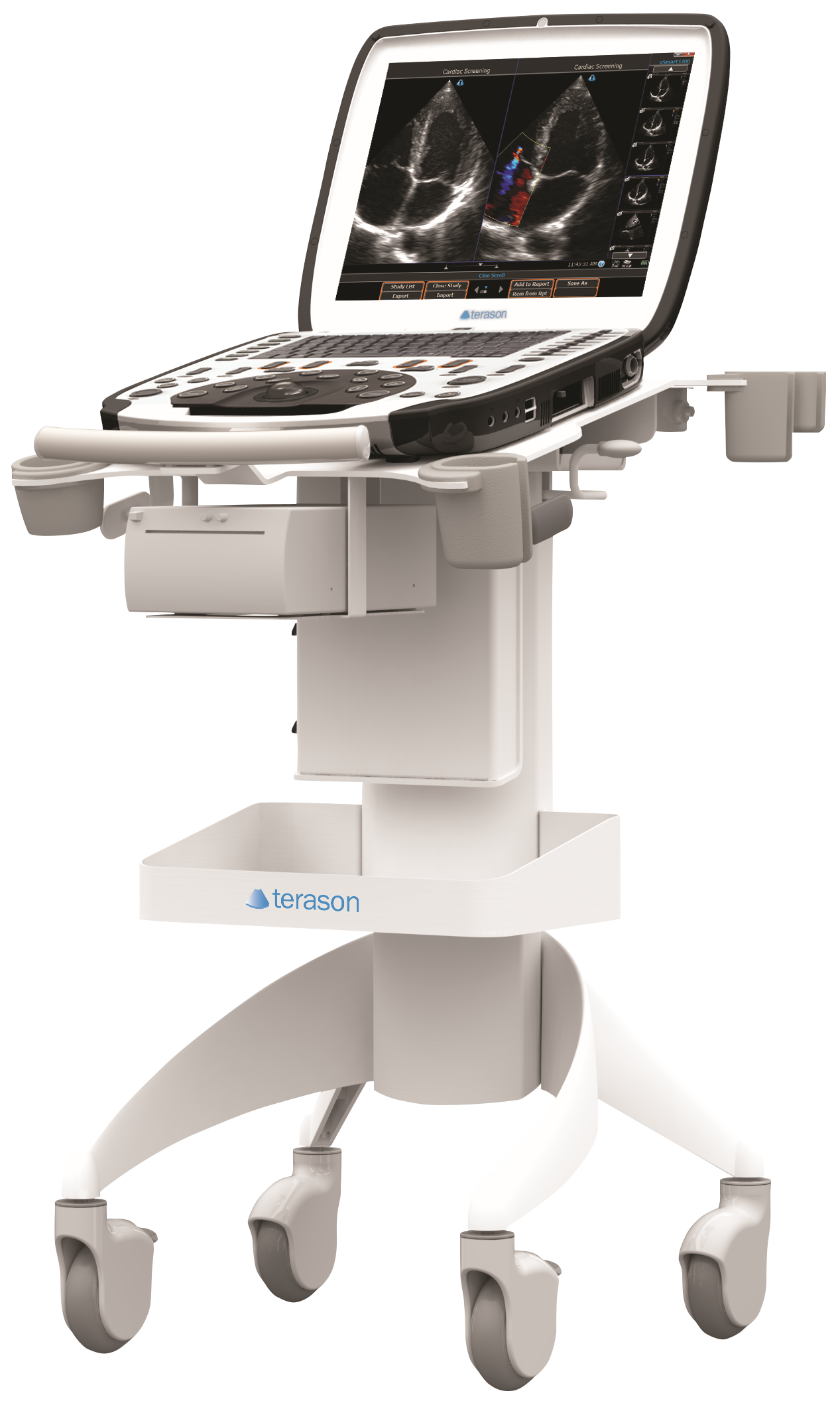 Terason uSmart 3300